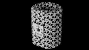 Il sistema Ossera AFX di restor3d per la fusione della caviglia