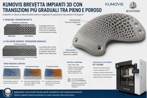Kumovis deposita una domanda di brevetto per impianti stampati in 3D con transizioni più graduali tra zone solide e porose