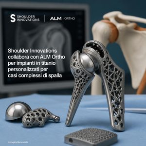 Shoulder Innovations e ALM Ortho