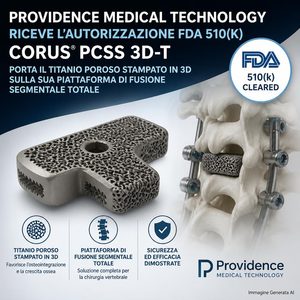 Providence CORUS PCSS 3D-T titanio poroso stampato in 3D per la fusione cervicale